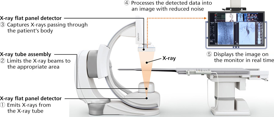 How X-ray angiography works