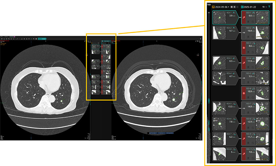 Monitor screen image of the “region-of-interest comparison function.