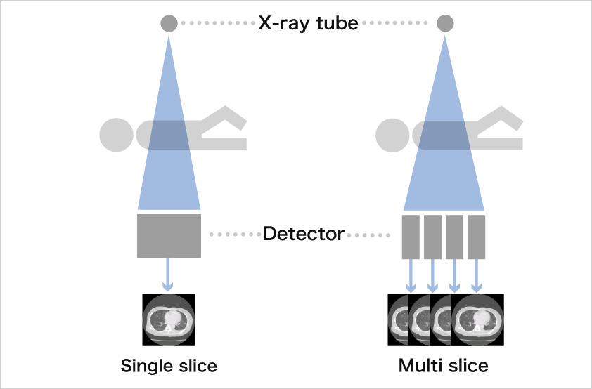 Illustration of ｃomparison between single slice and multi-slice