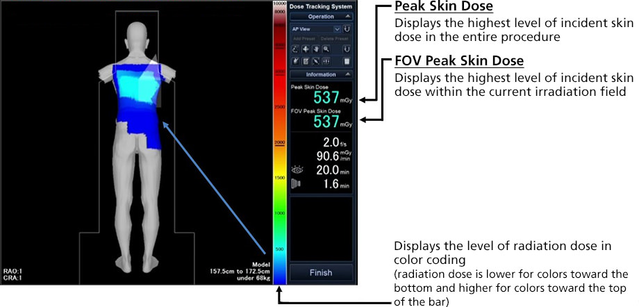 Image of Dose Mapping Function