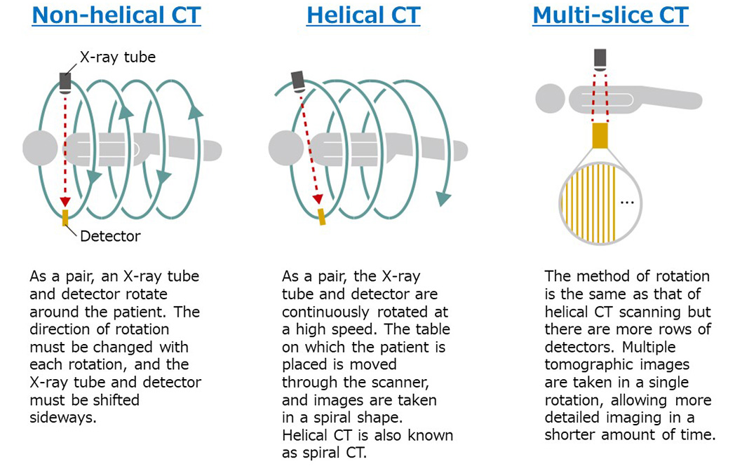 Figure comparing the differences among three methods: 