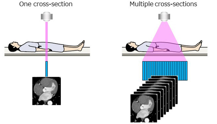 A diagram depicting the number of images obtained with one rotation of the detector