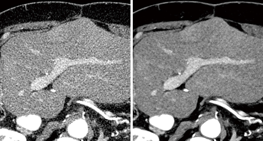 A comparison of images obtained using conventional technology (left) and AiCE (right). 