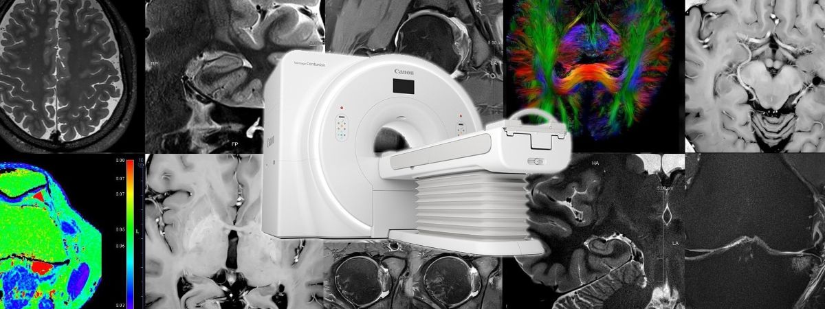 An MRI Image Processing Technology