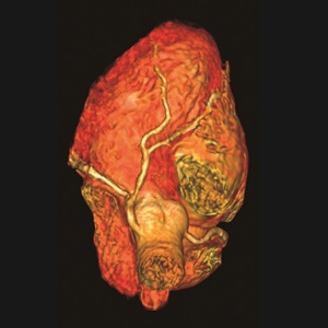 Cardiovascular MRI image