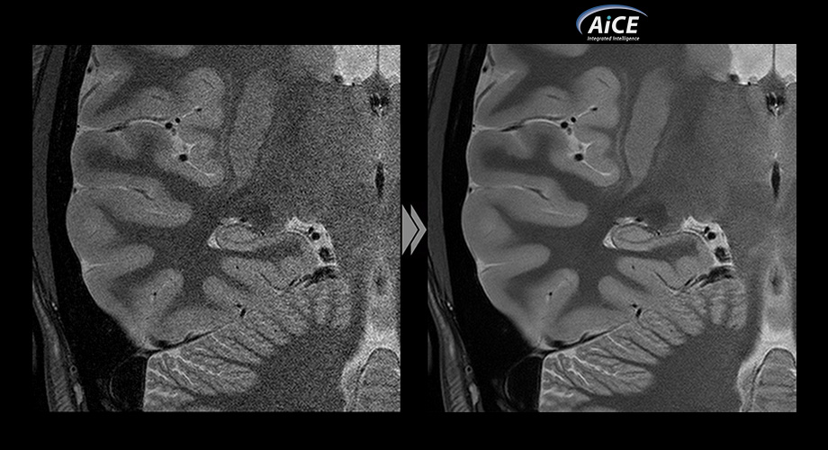 Image reconstruction using AiCE