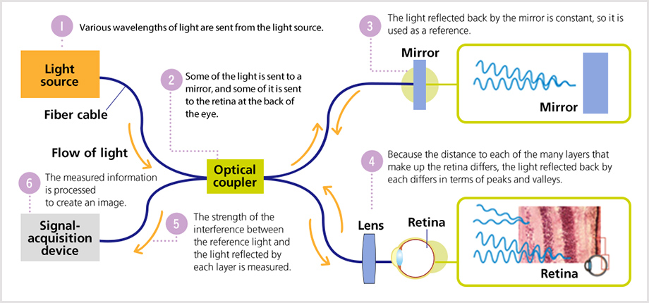 Illustration explaining how OCT works