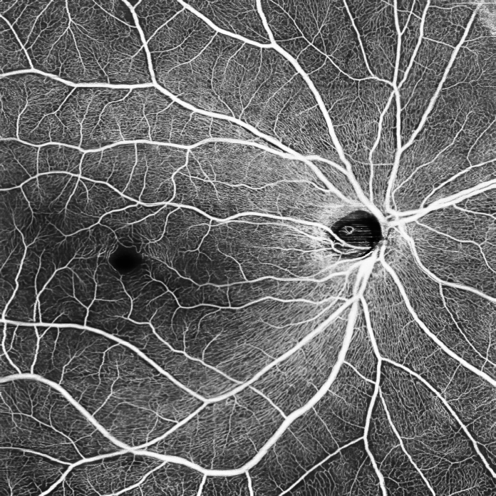 Fundus OCTA image