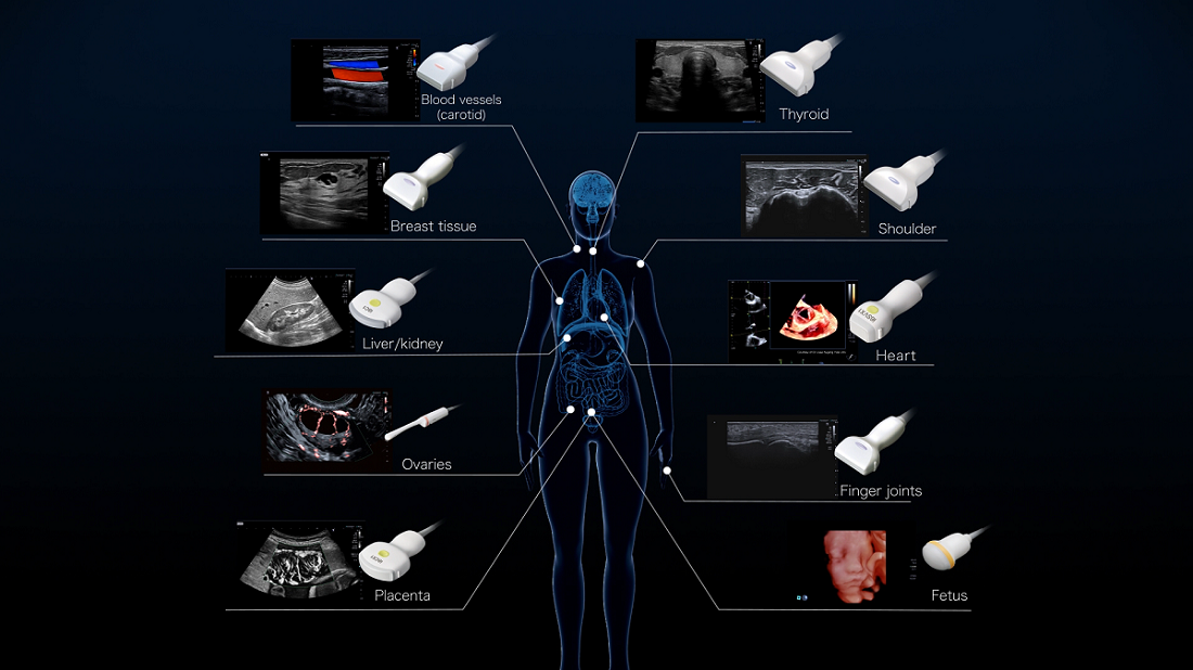 This image shows how images appear for different parts of the body