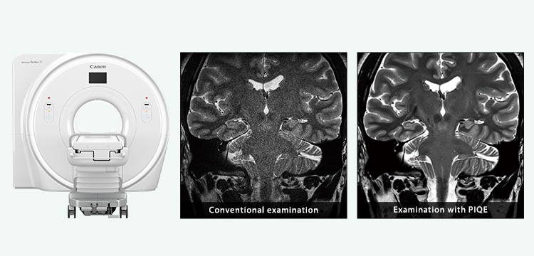 Technologies to improve MRI image quality