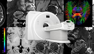AiCE: An MRI Image Processing Technology