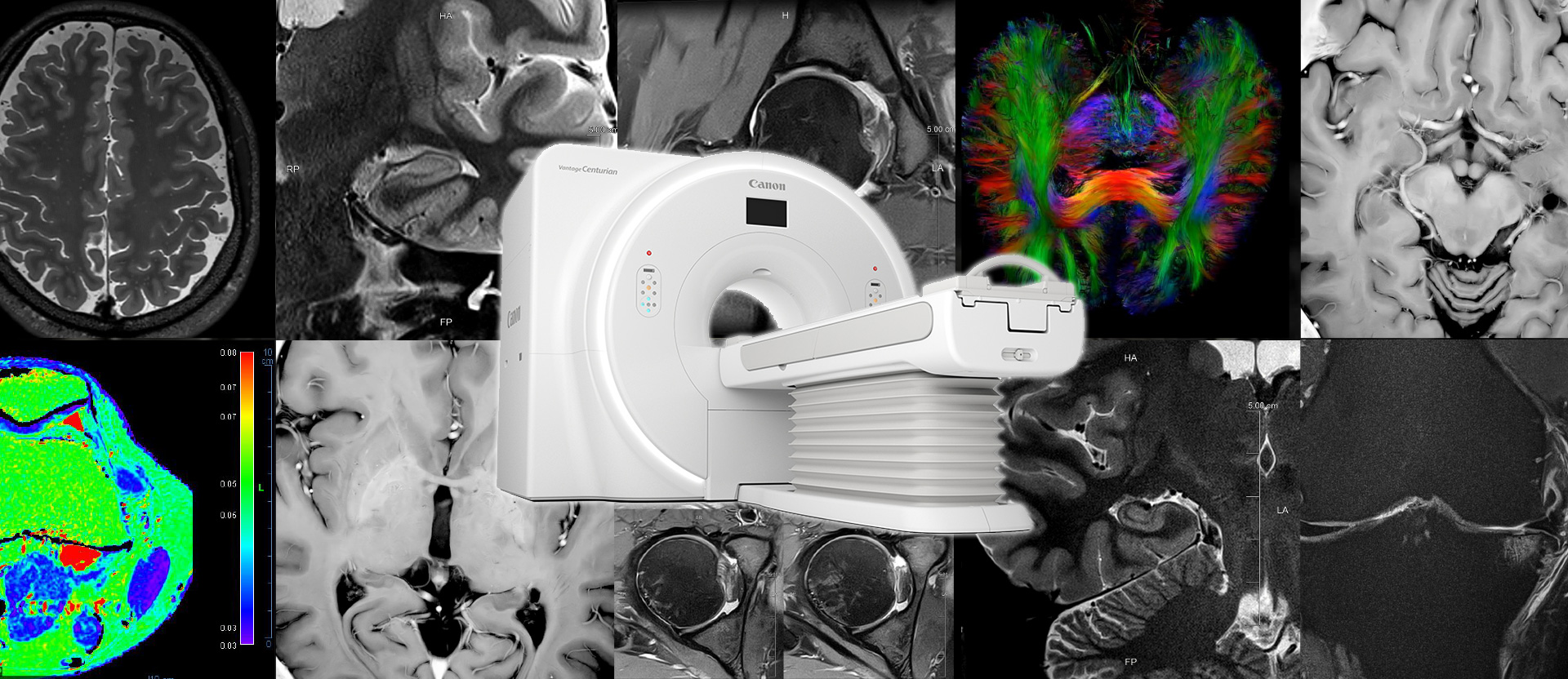 Deep Learning in MRI: Improved Image Quality, Shorter Examination Times