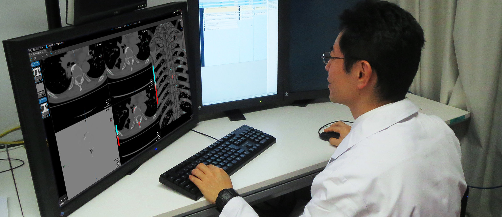 Technology supporting early detection of bone metastasis