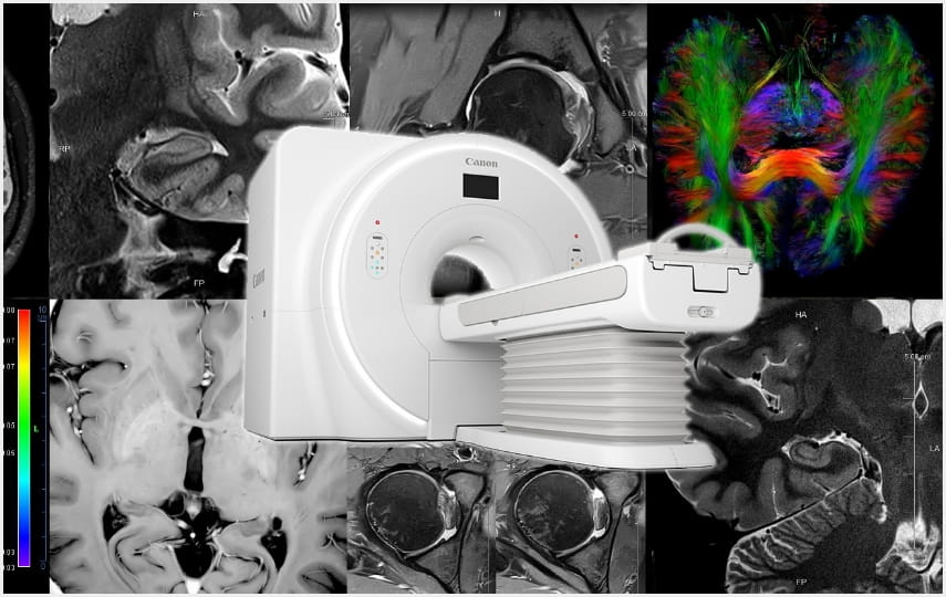 MRI画像処理技術