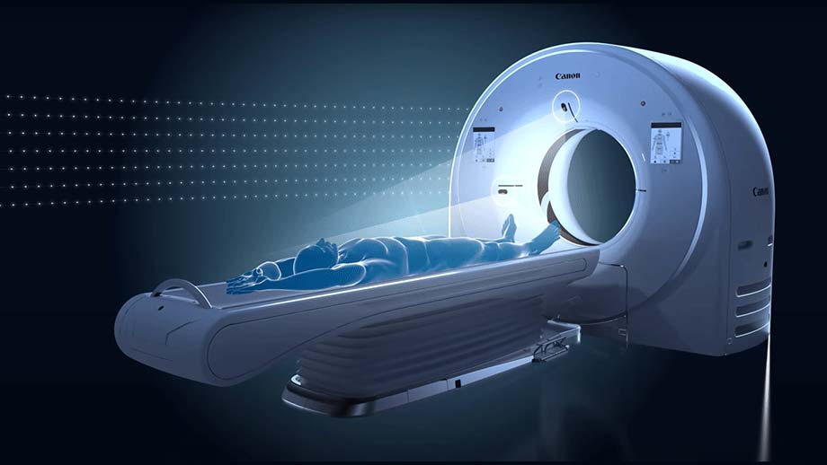 患者さんの骨格特徴から関節位置などを検出するイメージ図