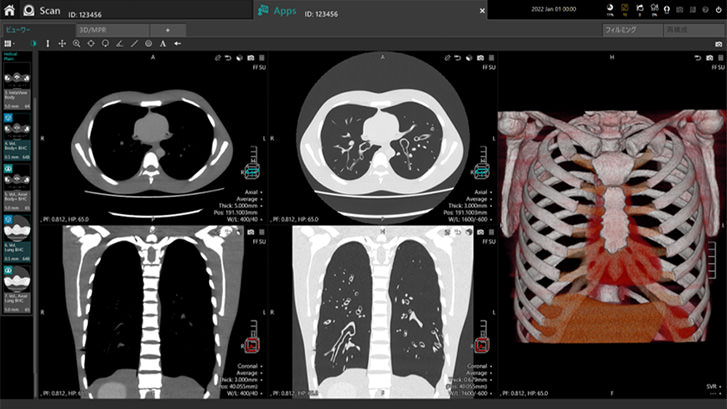 シンプルで使いやすいインターフェースの説明画像