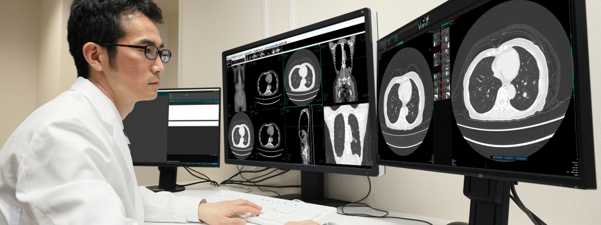 がんの早期発見を支援する読影システムのメインビジュアル