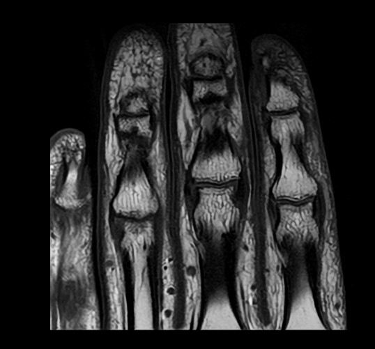 キヤノンのMRI装置で撮像した手の指の臨床画像