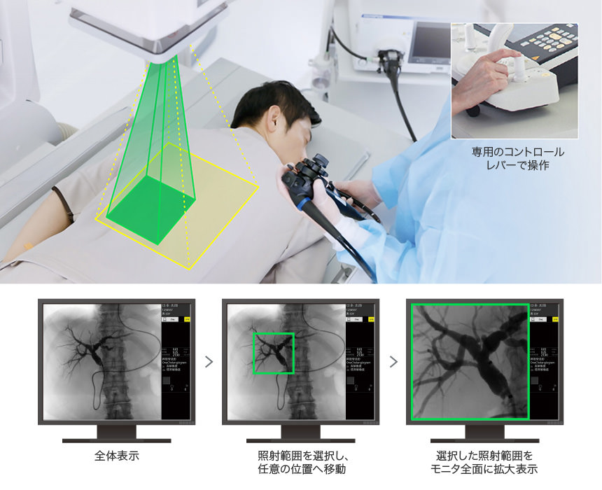 キヤノンのデジタルX線TVシステムでの検査シーンイメージ