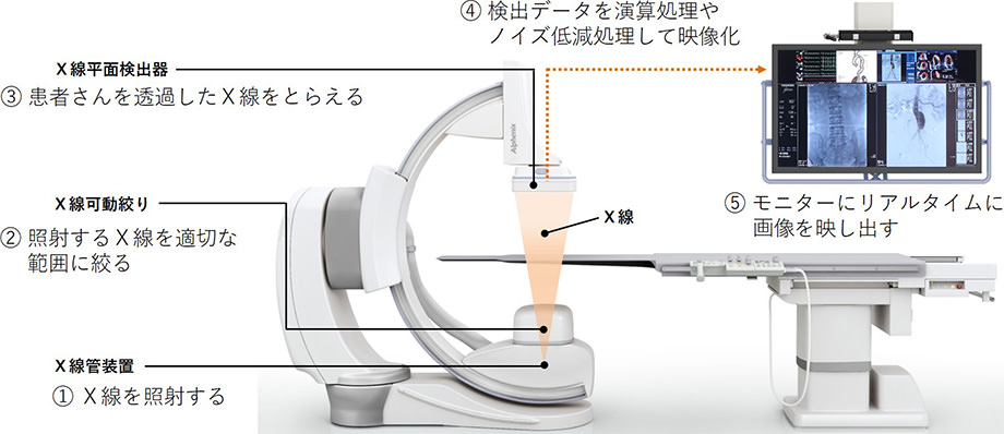X線アンギオグラフィのしくみ説明図