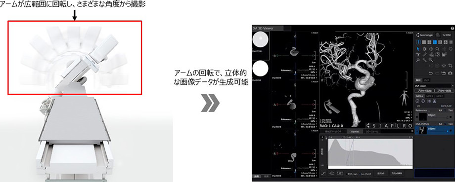 アームを回転させながら撮影したデータを活用し血管の3Dデータを構築するイメージ図
