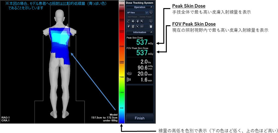 線量マッピング機能Dose Tracking System (DTS)画面イメージ図