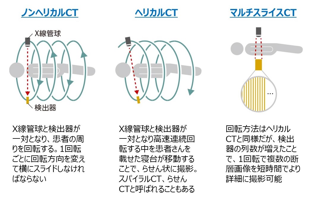 ノンヘリカルCT・ヘリカルCT・マルチスライスCTにおいて、撮影時にガントリ内のＸ線管と検出器の動き方が異なることが分かる比較図