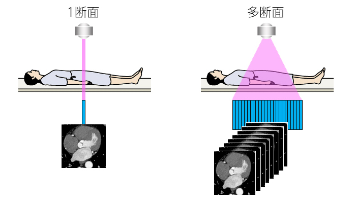 検出器1回転で得られる画像の枚数イメージ図