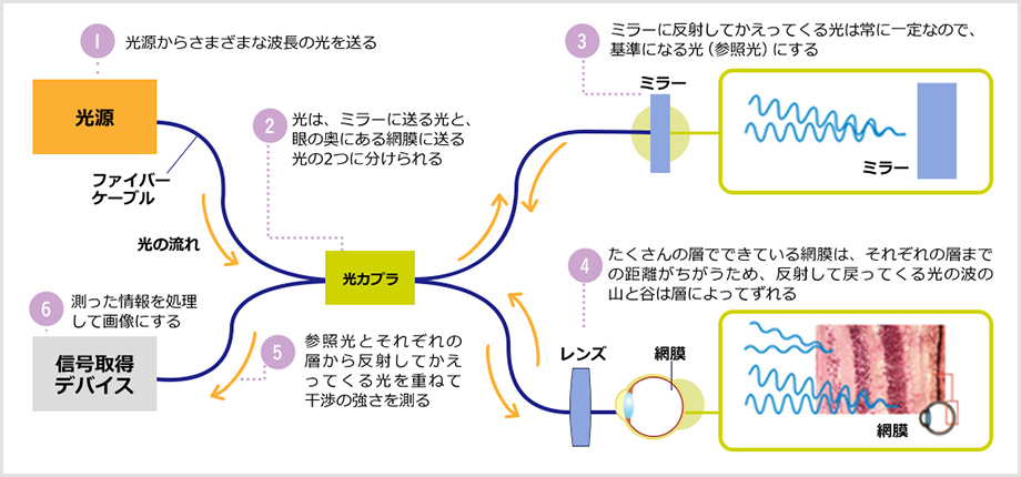 OCTのしくみをまとめた絵