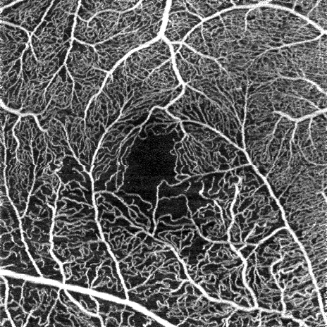 Intelligent denoiseの処理前と処理後の違い