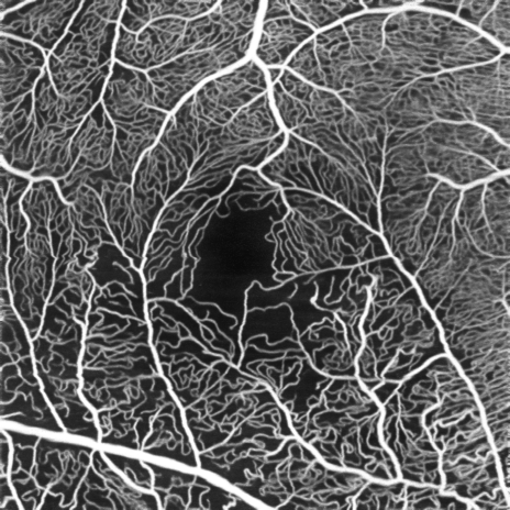 Intelligent denoiseの処理前と処理後の違い