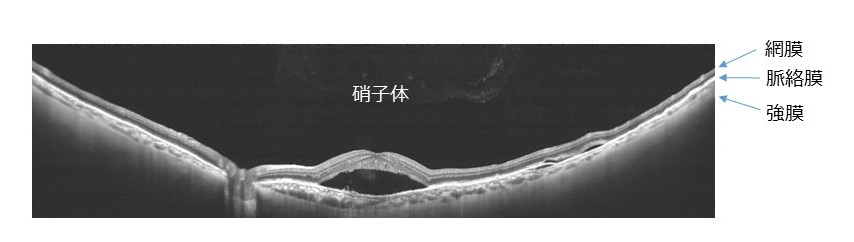 幅広い範囲を一度の撮影で高精細に画像化した画像