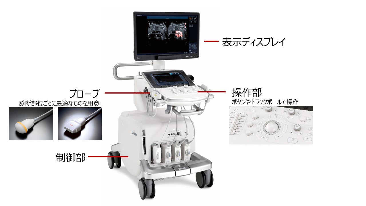 超音波診断装置のユニットを紹介する画像です。