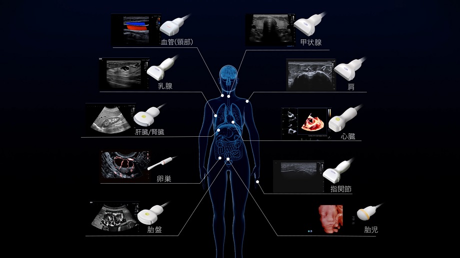 部位ごとの画像の見え方を紹介する画像です。