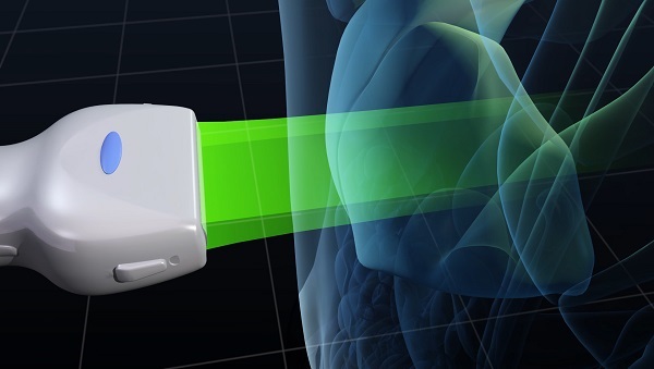 ビームの幅が厚いと不要な情報も多いことを説明するイラストです。